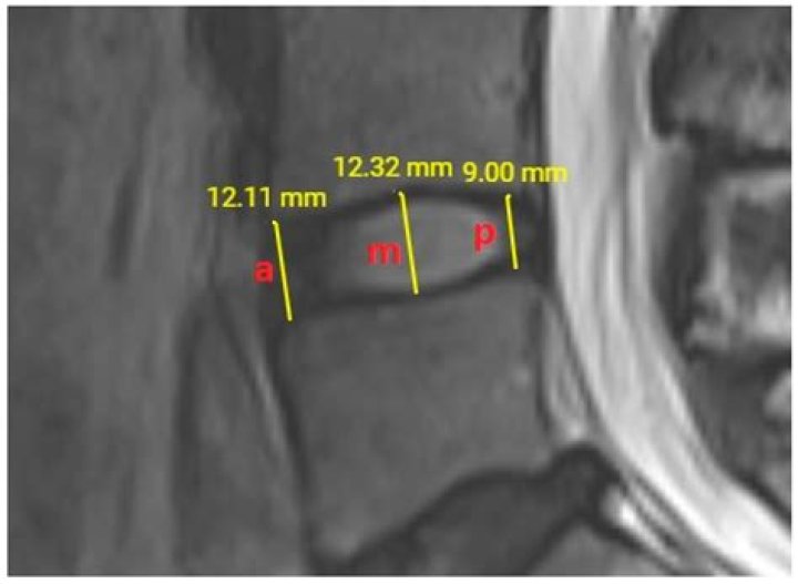 Tony Cox's Height Disclosed: Uncovering The Actor's Stature
